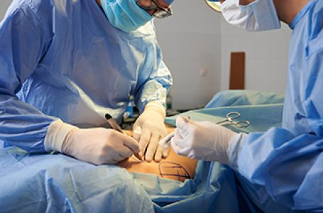 Cirurgia plástica pós procedimento bariátrico