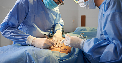 Cirurgia plática bariátrica para retirada do excesso de pele após emegracimento é importante