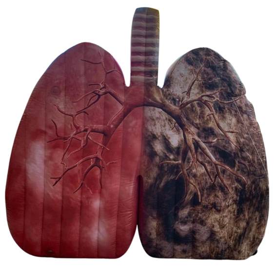 Pulmão gigante percorre Campinas para conscientizar sobre o câncer de pulmão