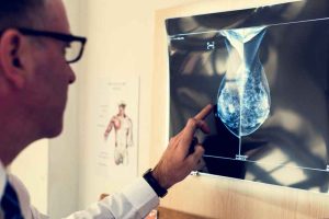 Resultado da mamografia tem forte influência no sucesso nas cirurgias de câncer de mama 2 Medico avalia exame de imagem rawpixel Divulgacao