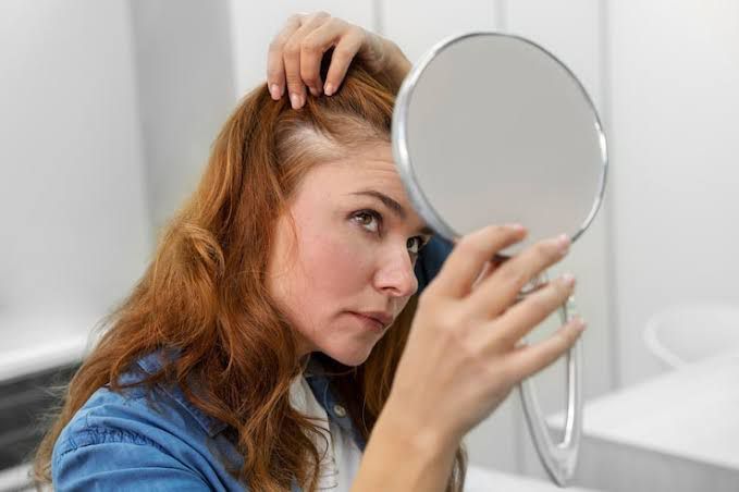 Setembro do Equilíbrio: 5 sinais de que o estresse já está no seu corpo 1 Queda de cabelo pode ser alerta de estresse Divulgacao