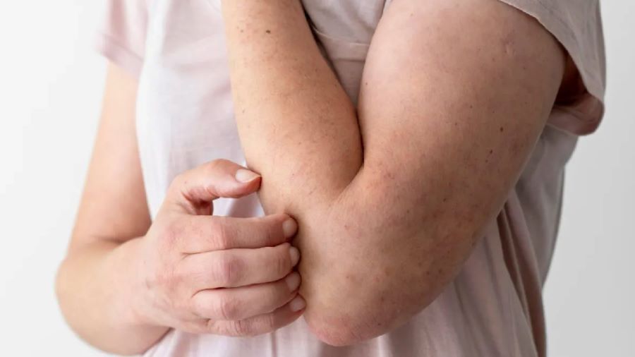 Janeiro Roxo chama a atenção a importância do diagnóstico precoce da hanseníase