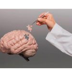 Alzheimer avança no Brasil: SUS registra 56,2 milhões de atendimentos em um ano