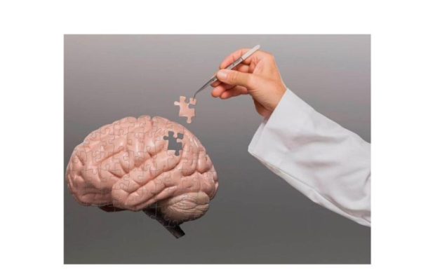 Alzheimer avança no Brasil: SUS registra 56,2 milhões de atendimentos em um ano