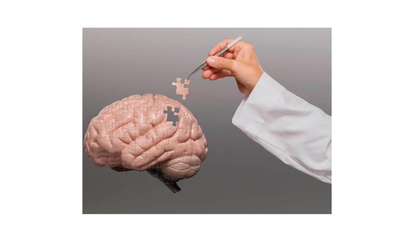 Demencia ainda e um desafio para especialistas Divulgacao