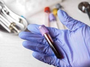 Teste de sangue para diagnostico de cancer de mama Divulgacao