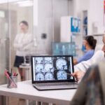 Tratamento do AVC avança com adoção da tenecteplase em hospital de Campinas