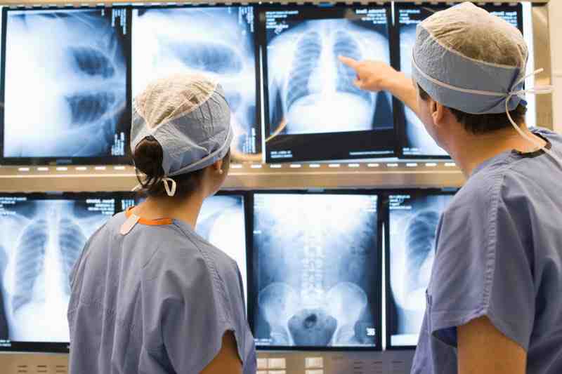 Medico analisa exames de imagem Divulgacao