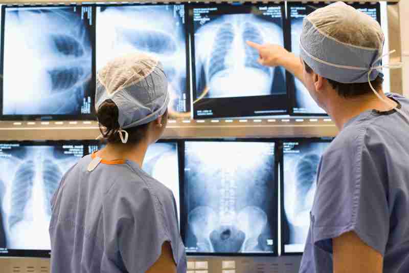 Novo protocolo propõe avanços no tratamento do câncer de pulmão para pacientes do SUS